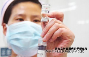 银屑病常见的几种病因