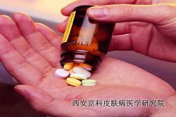 怎样控制银屑病的发展