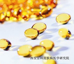 怎么做防止银屑病