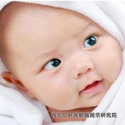 儿童银屑病冬季护理