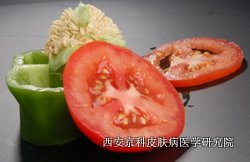 银屑病能吃西红柿吗